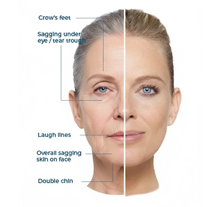 Considering anti-ageing treatment in Ahmedabad