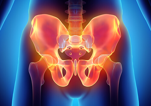 Ovarian Vein Embolization