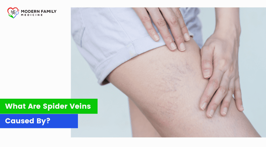 What Are Spider Veins Caused By?