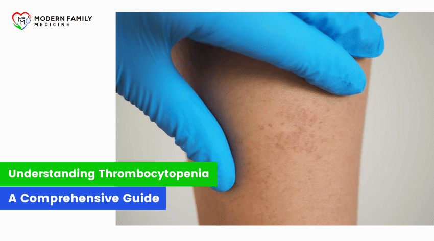 Understanding Thrombocytopenia: A Comprehensive Guide