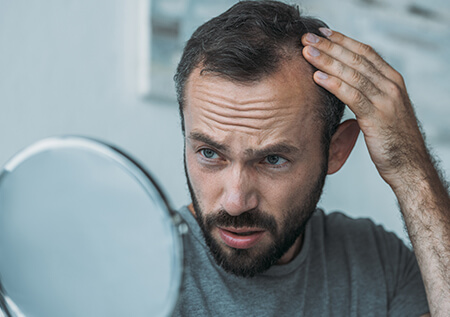 Baldness Treatment