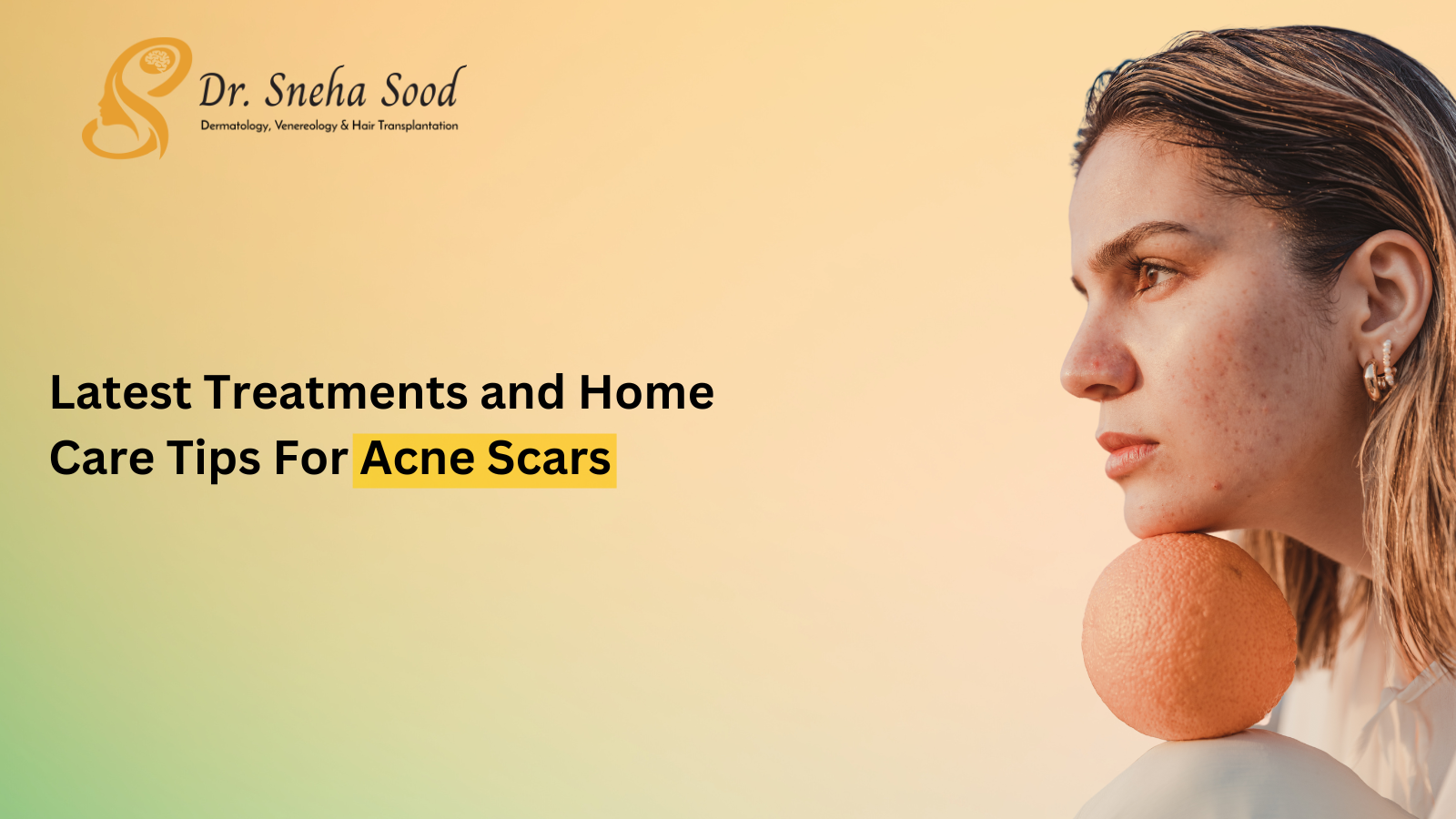 acne scars treatment