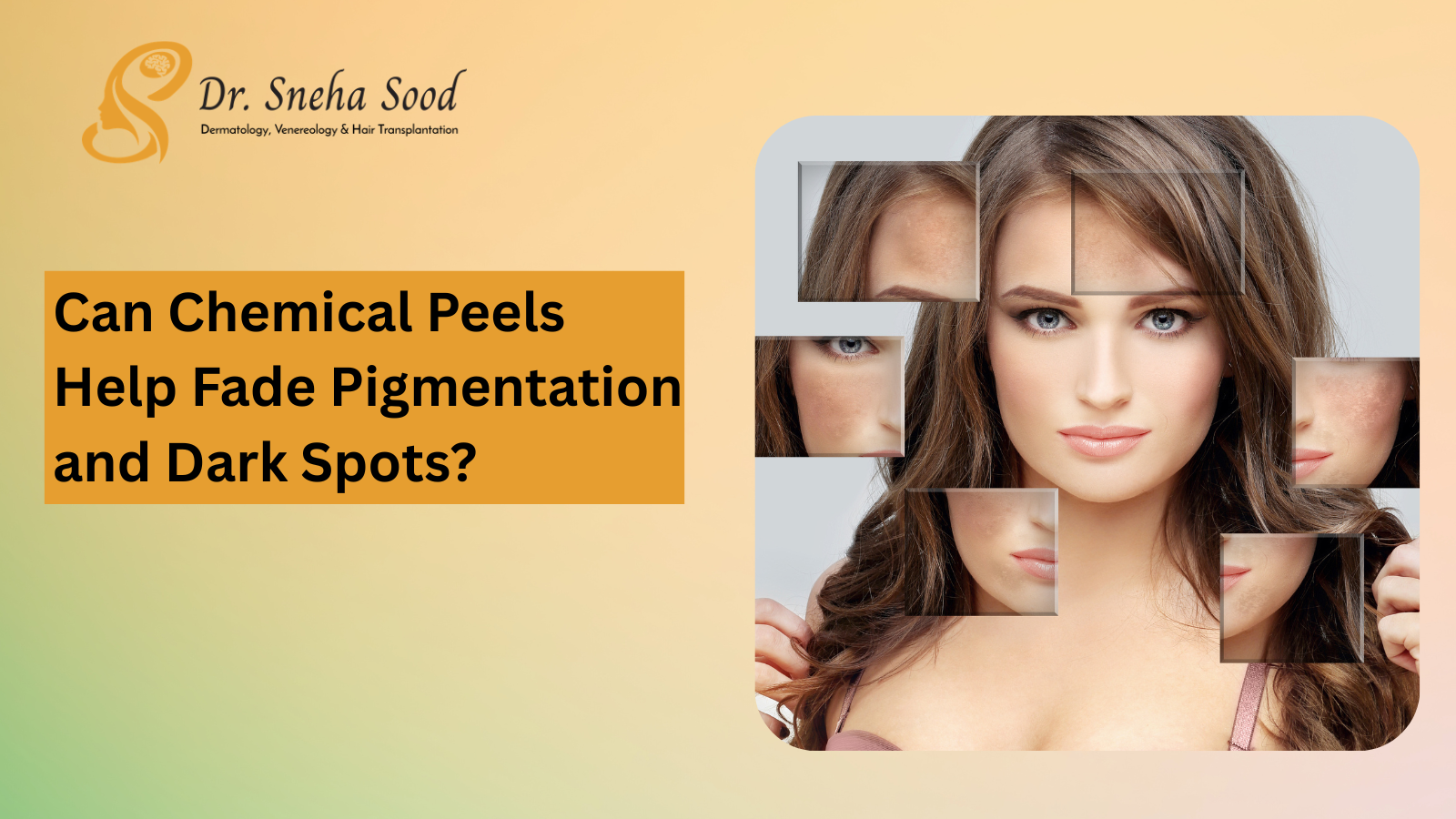 Can Chemical Peels Help Fade Pigmentation and Dark Spots? 