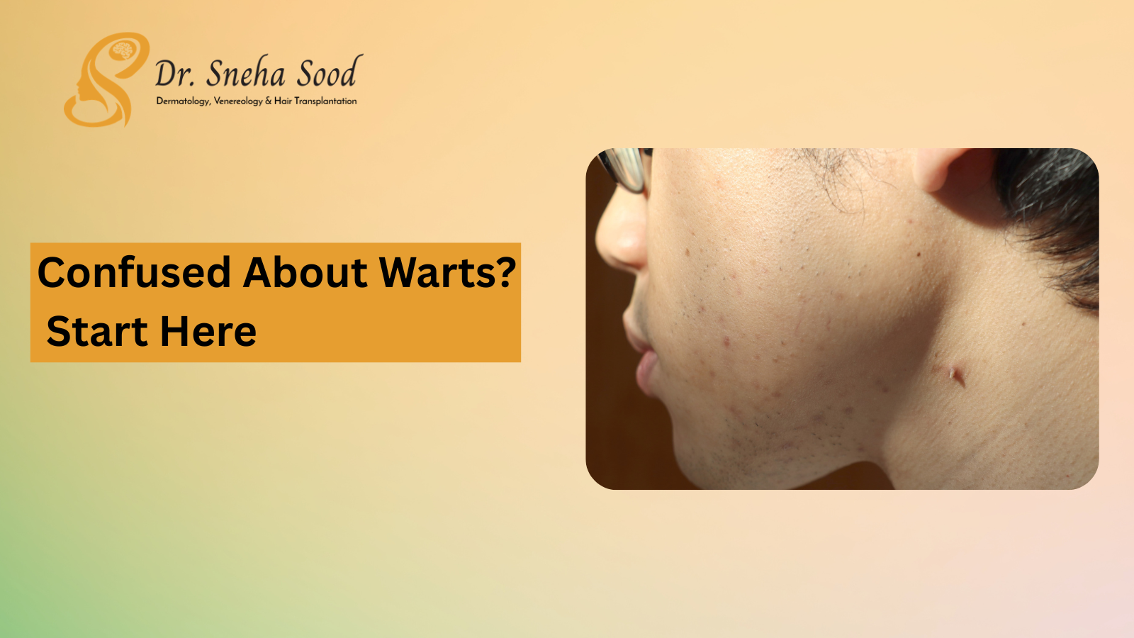 Wart removal treatment dermatologist Bangalore skin clinic