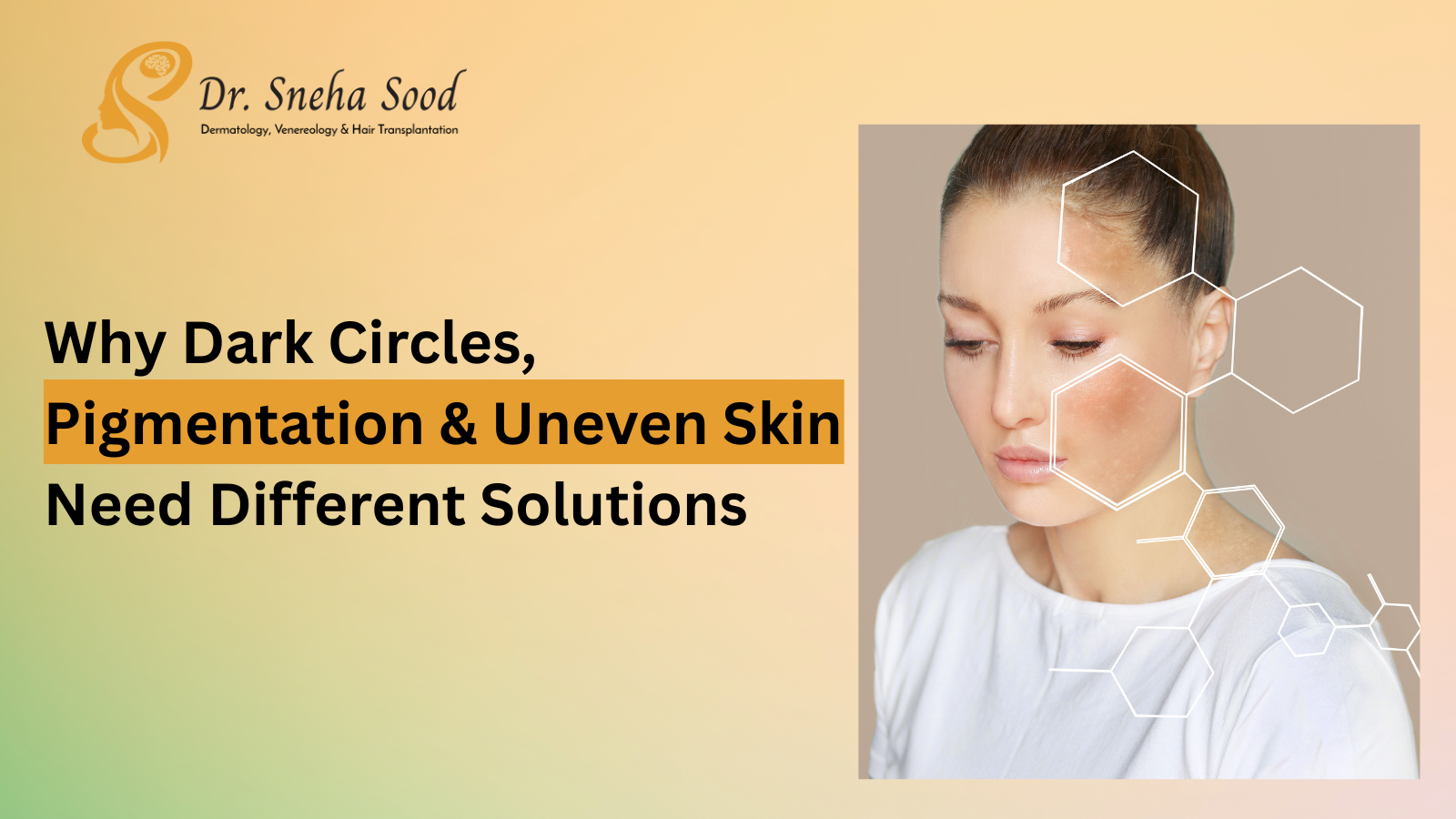 Dark Circles, Pigmentation & Uneven Skin