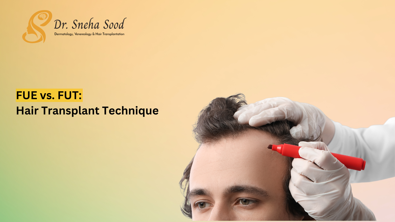 hair transplant
