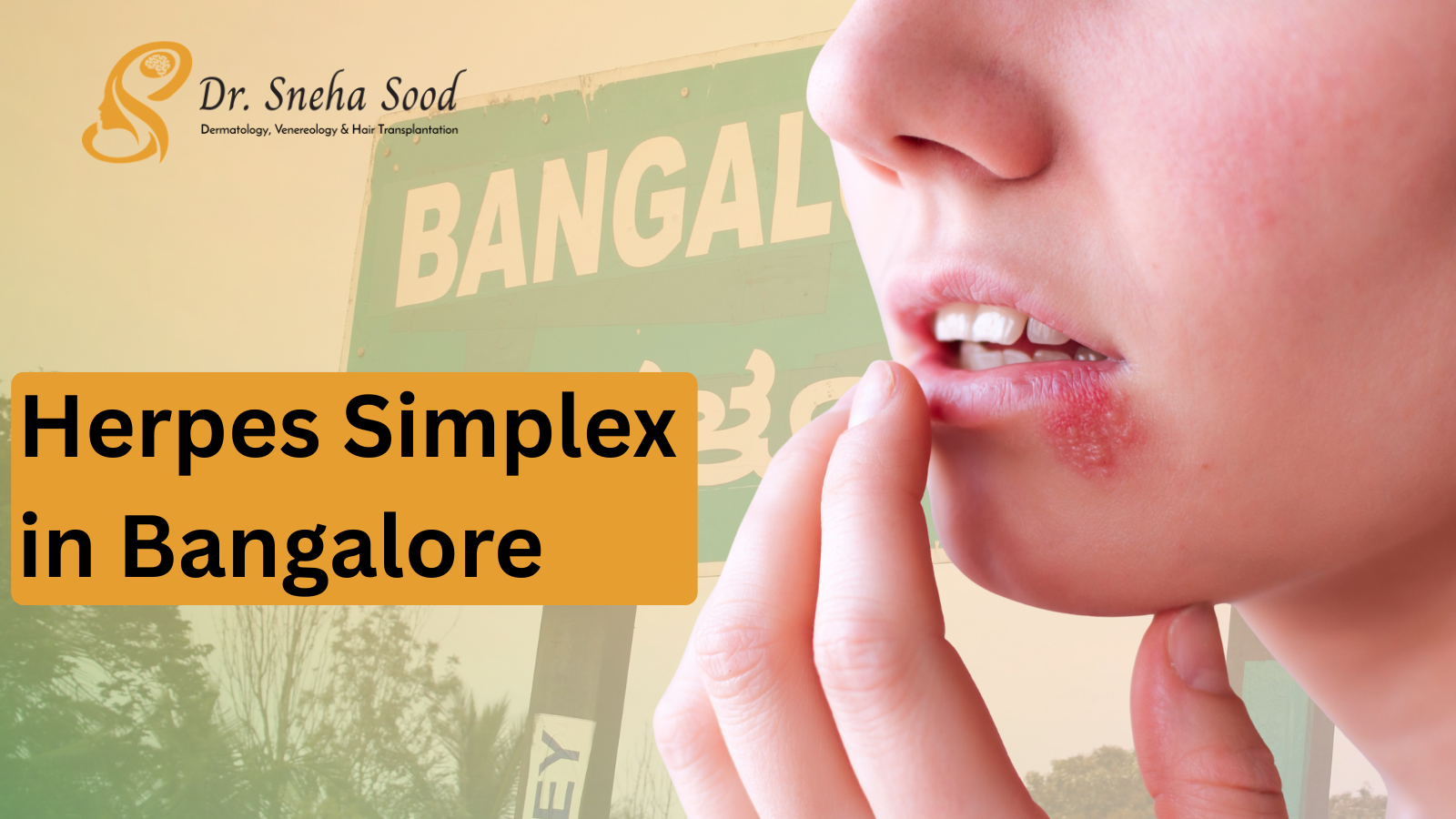 Herpes Simplex in Bangalore: What You Need to Know About Management, Prevention, and New Treatments