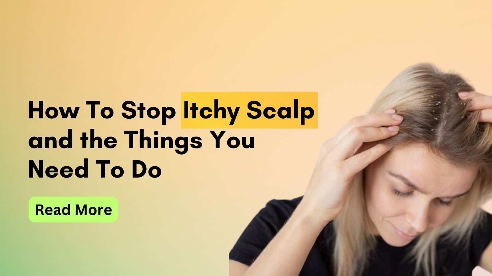 How to Stop Itchy Scalp