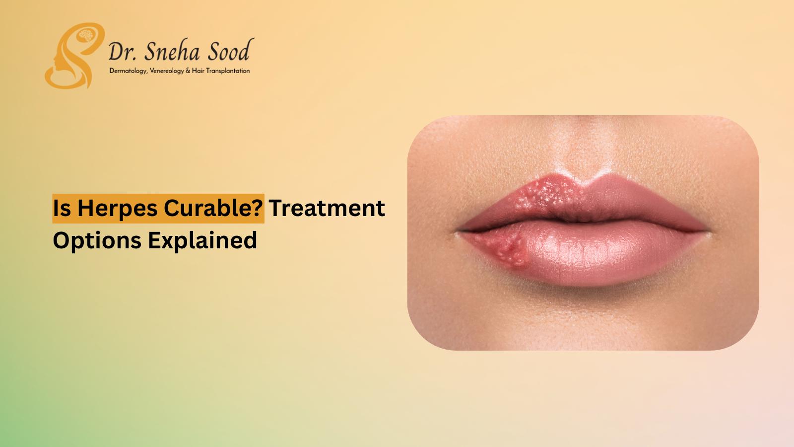 Is Herpes Curable? Treatment Options Explained