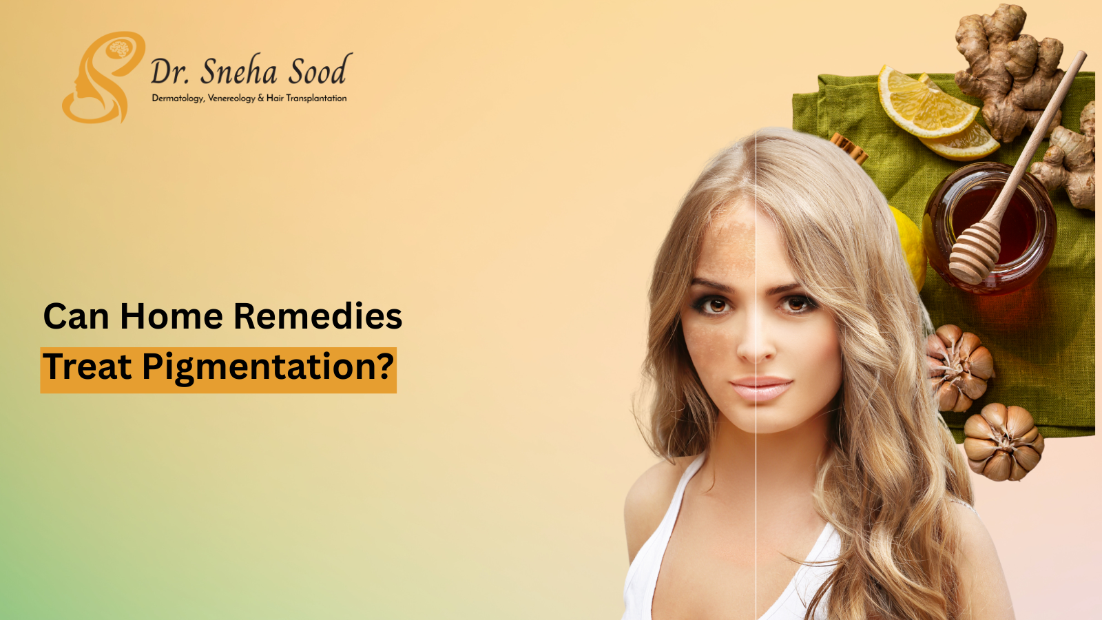 pigmentation home remedies