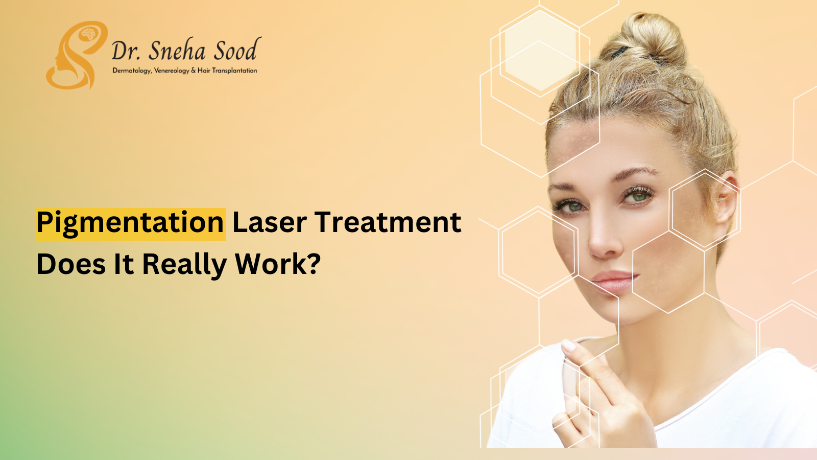 Laser Treatment for Pigmentation: Does It Really Work?