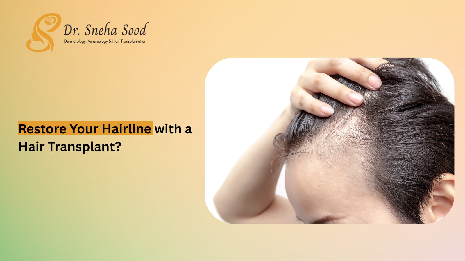 Can a Hair Transplant Restore Your Hairline? Here’s the Truth
