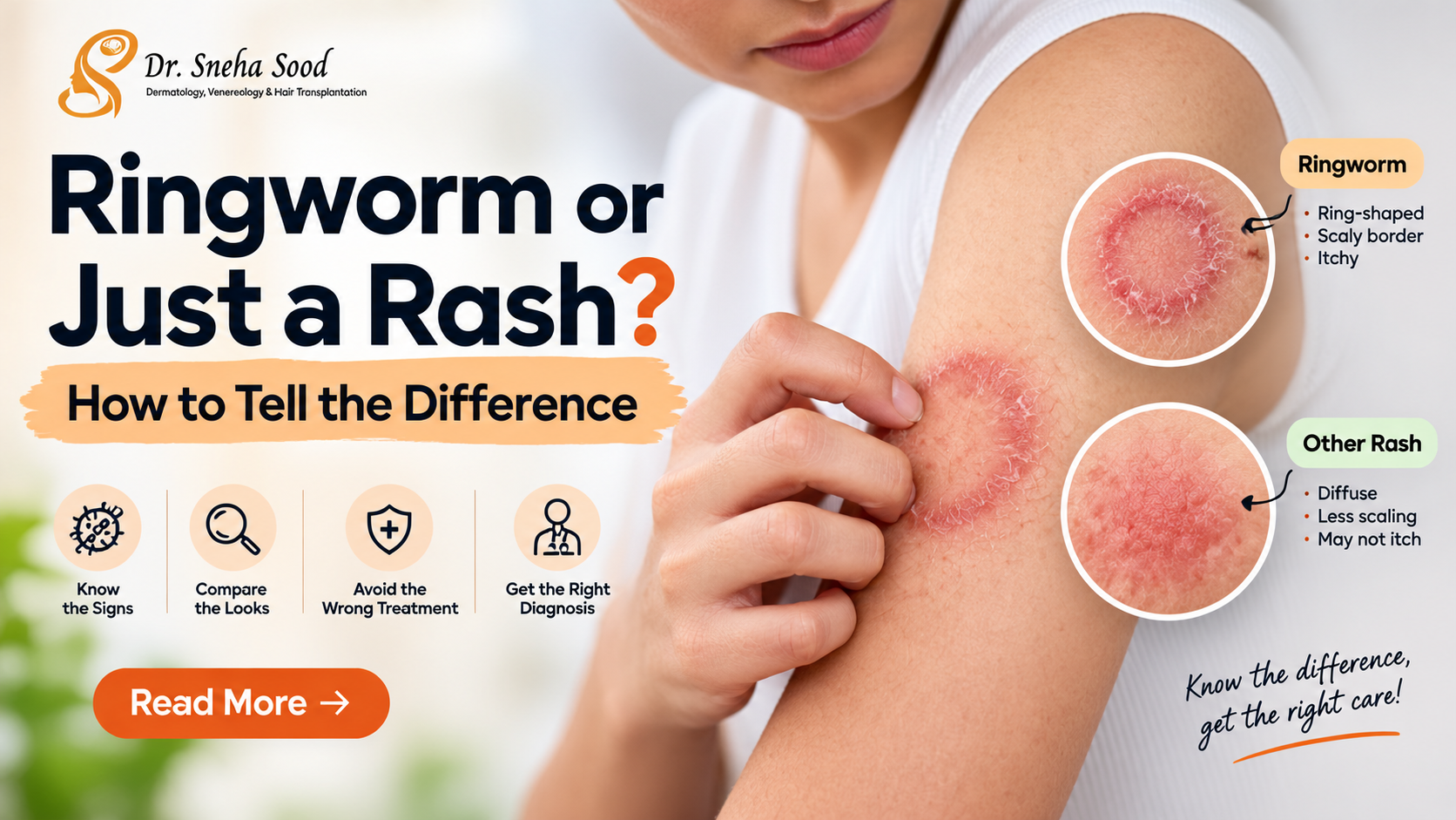 Ringworm or Just a Rash? How to Tell the Difference