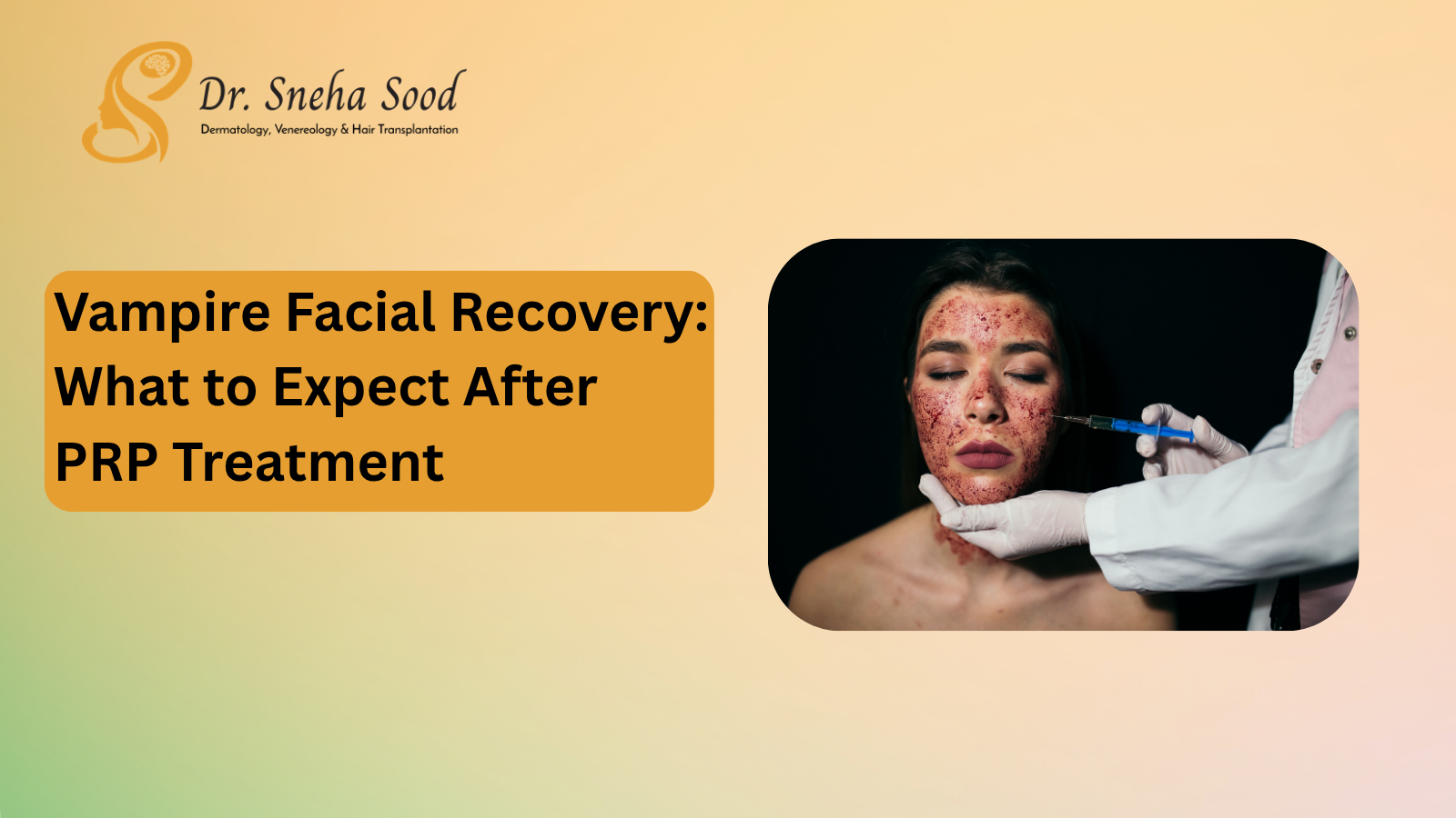 Vampire Facial Recovery: What to Expect After PRP Treatment