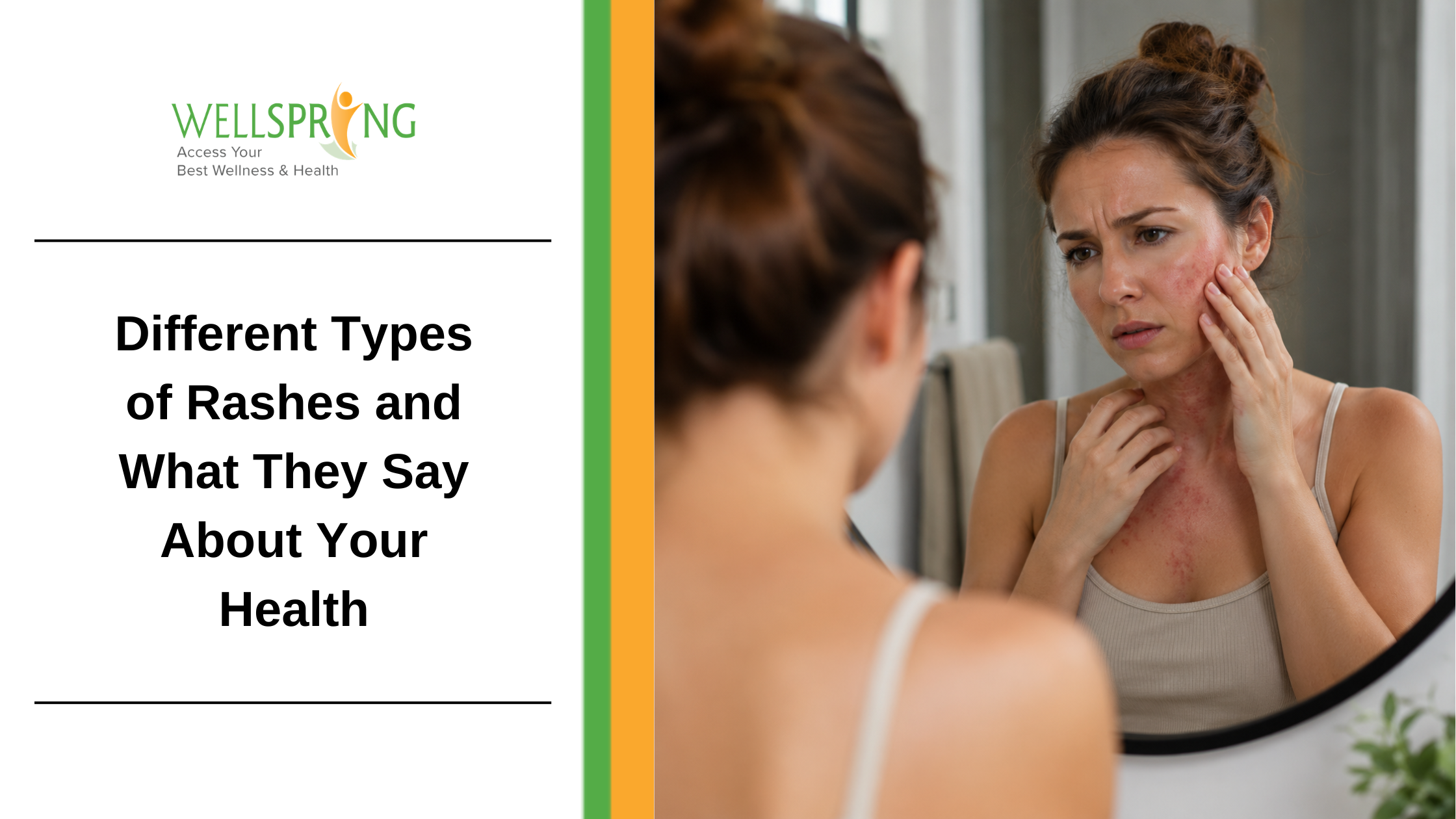 Different Types of Rashes and What They Say About Your Health