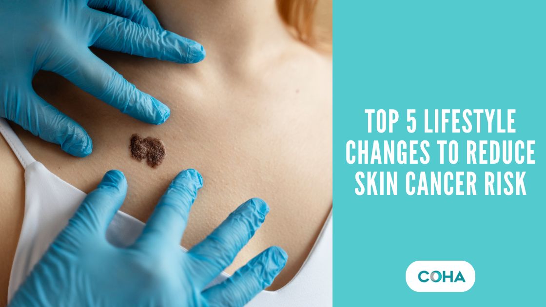 Top 5 Lifestyle Changes to Reduce Skin Cancer Risk