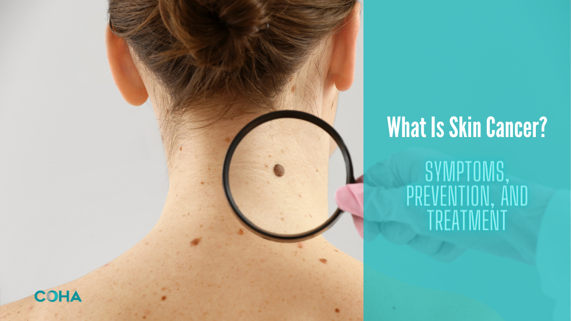 Skin Cancer