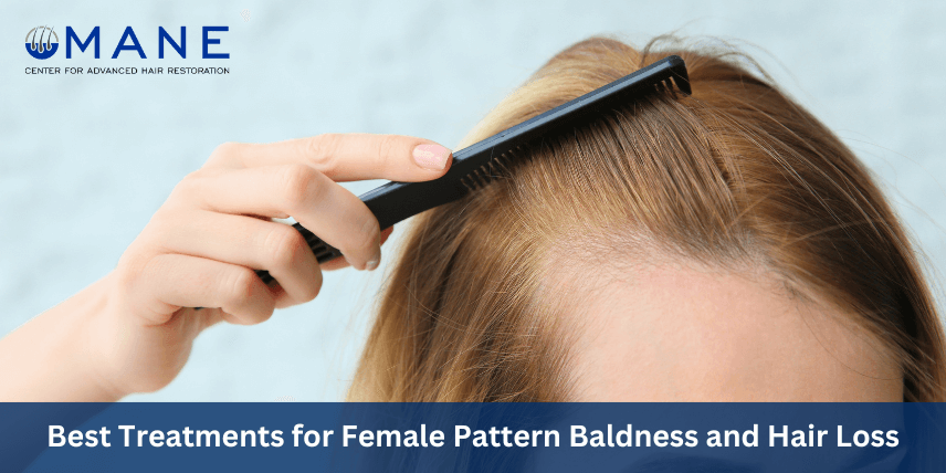 female-baldness-treatment