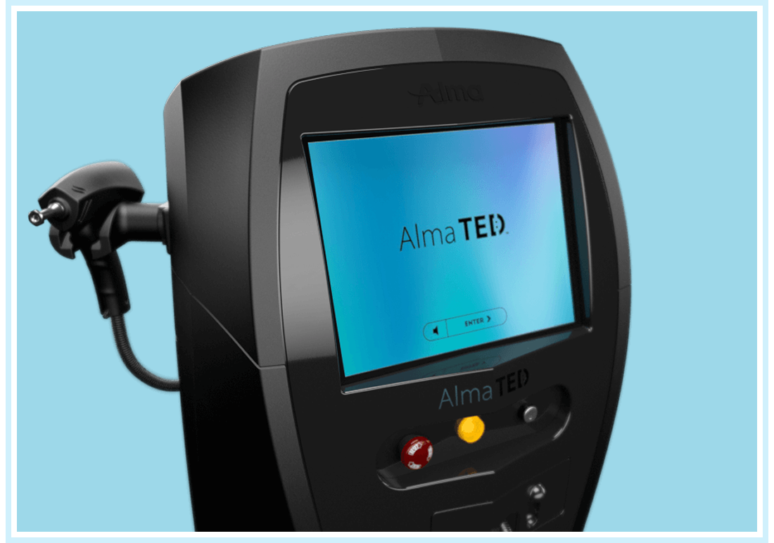 Alma TED for hair restoration