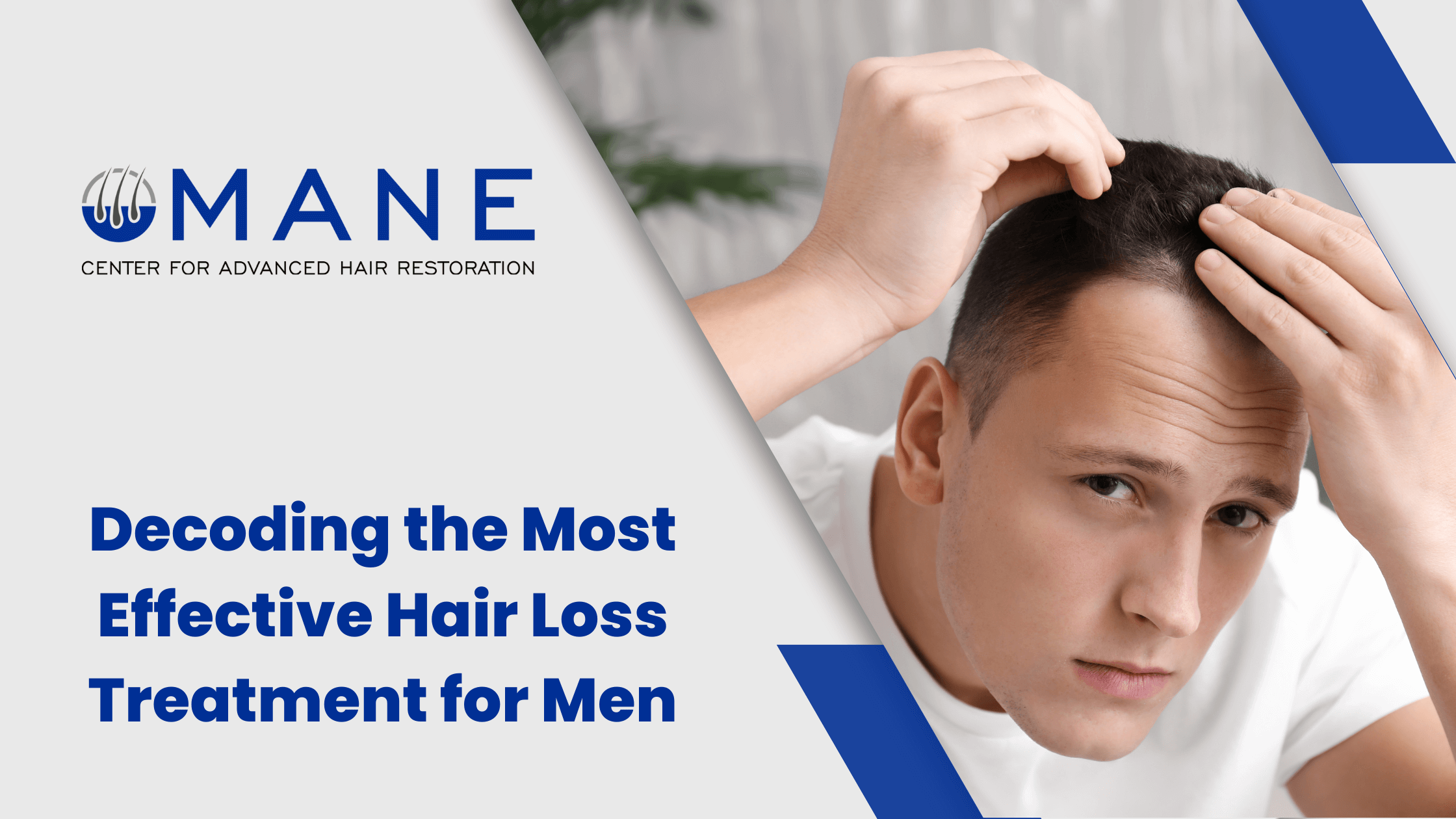 Decoding the Most Effective Hair Loss Treatment for Men