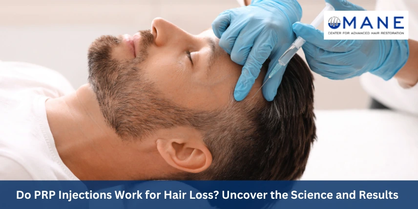 Do PRP Injections Work for Hair Loss? Uncover the Science and Results