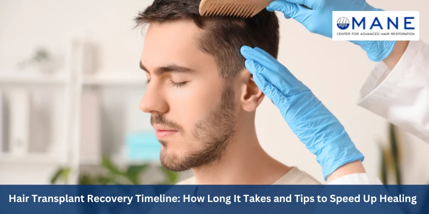 Hair Transplant Recovery Timeline: How Long It Takes and Tips to Speed Up Healing