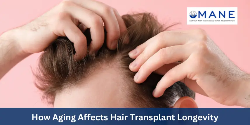 How Aging Affects Hair Transplant Longevity