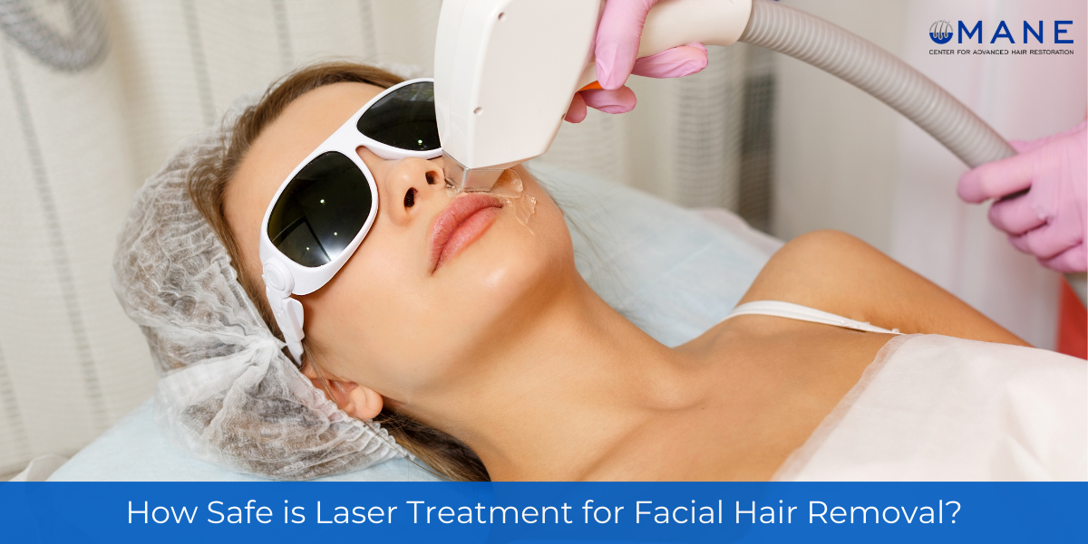 Laser treatment for facial hair removal