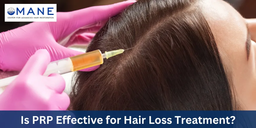 PRP Therapy: An Effective and Safe Treatment for Hair Loss 