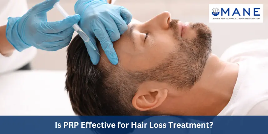 Is PRP Effective for Hair Loss Treatment?