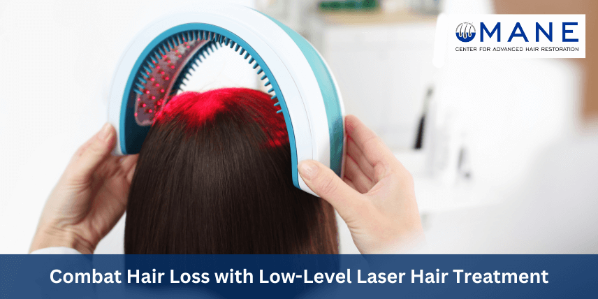 Combat Hair Loss with Low-Level Laser Hair Treatment