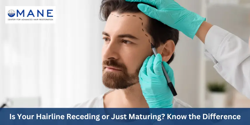 is-your-hairline-receding-or-just-maturing-know-the-difference