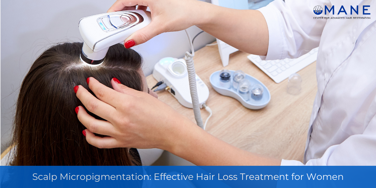 Scalp Micropigmentation: Effective Hair Loss Treatment for Women