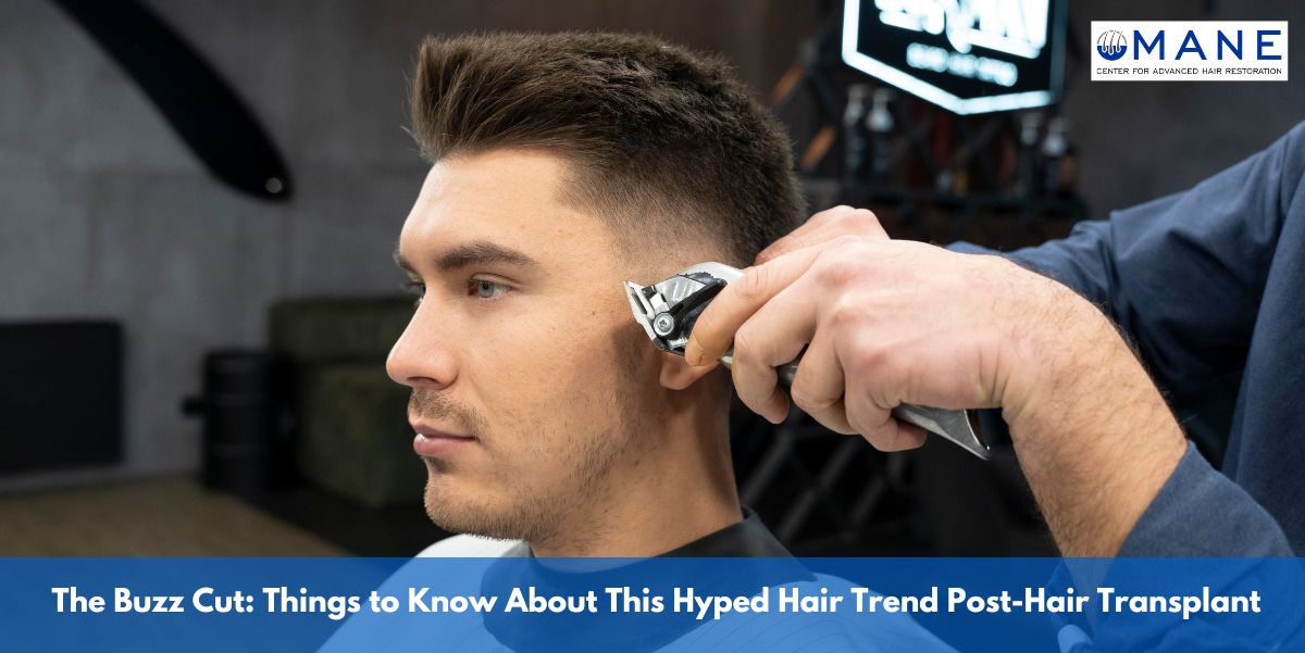 The Buzz Cut: Things to Know About This Hyped Hair Trend Post-Hair Transplant