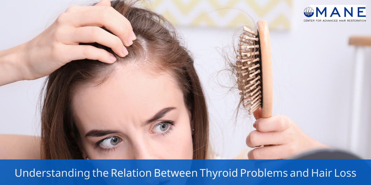 relation between thyroid problems and hair loss