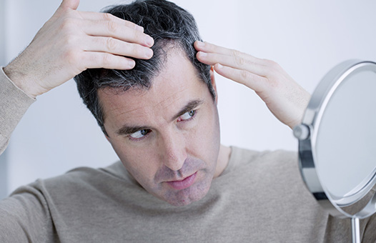 What is Medical Therapy for Hair Loss?