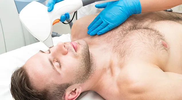What is the cost of laser hair removal