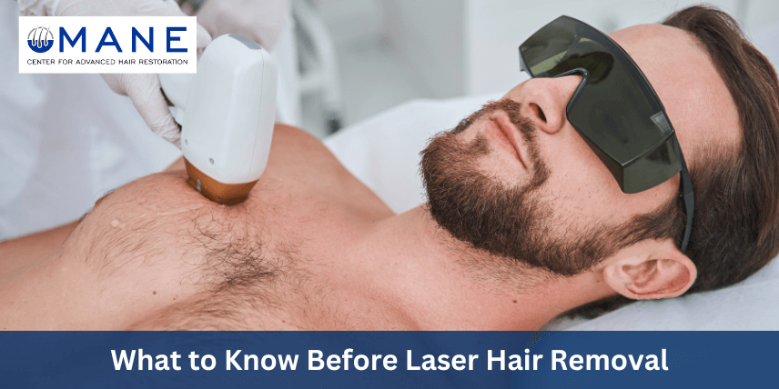 what-to-know-before-laser-hair-removal