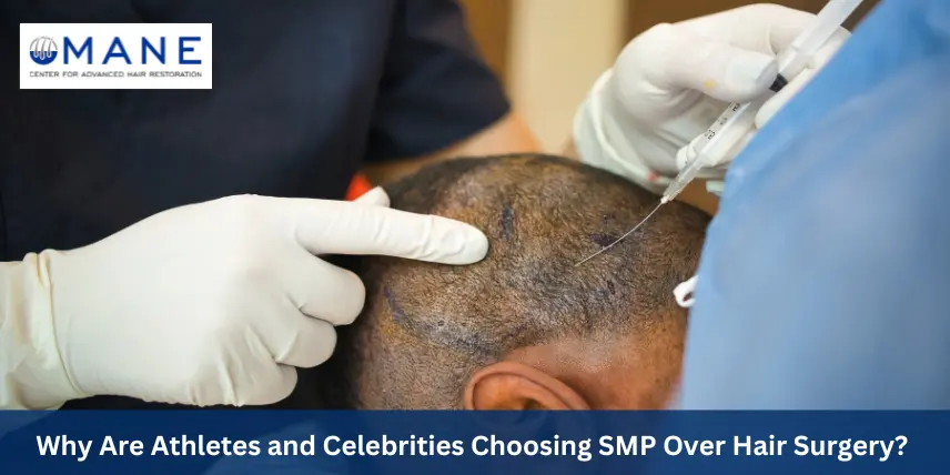 Why Are Athletes and Celebrities Choosing SMP Over Hair Surgery? 