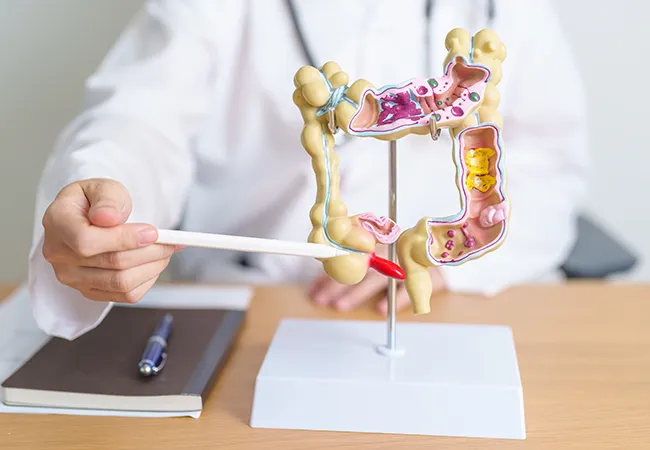 Trusted colon cancer screening at Cerritos Endoscopy Center