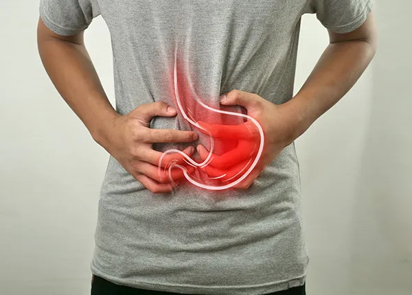 Expert GERD & Acid Reflux Care at Cerritos Endoscopy Center