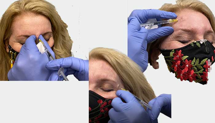 Botox®, Jeuveau®, and Dysport® TREATMENT IN NJ