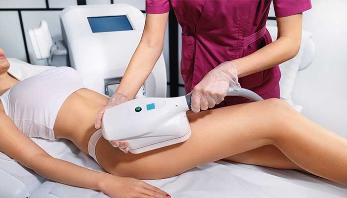 How Much Does Coolsculpting Cost?
