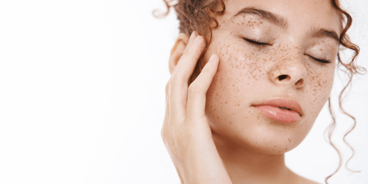 Say Goodbye to Sun Spots - How to Treat Dyschromia