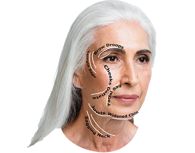 What Are the Signs of Aging?