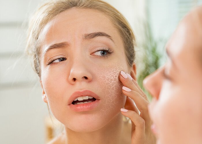WHO SHOULD AVOID LASER SKIN TREATMENT
